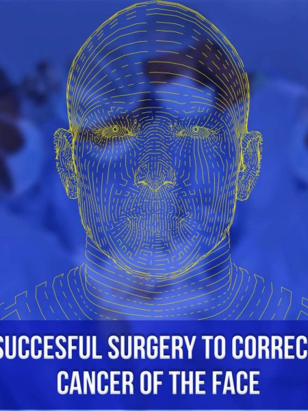 Successful Surgery To Correct Cancer Of The Face