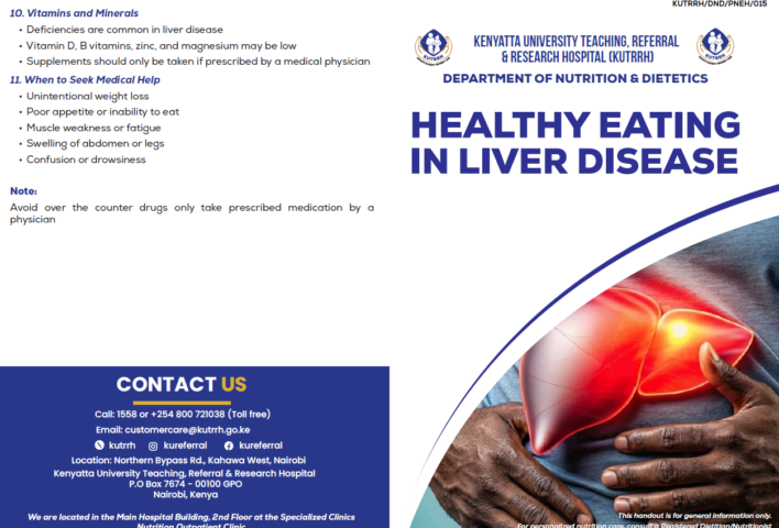 Healthy eating in liver disease