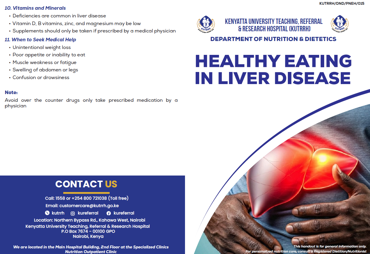 Healthy eating in liver disease