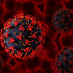 Sickle Cell Disease