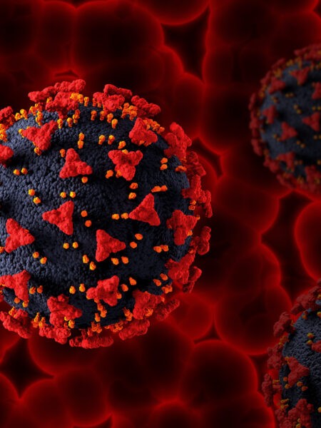 Sickle Cell Disease